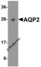 Aquaporin 2 antibody, 7621, ProSci, Western Blot image 