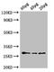 Arabidopsis thaliana L-ascorbate peroxidase 2,cytosolic antibody, A52938-100, Epigentek, Western Blot image 