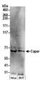 RNA Binding Motif Protein 39 antibody, A300-353A, Bethyl Labs, Western Blot image 