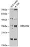 Ubiquitin-conjugating enzyme E2 J2 antibody, A11925, Boster Biological Technology, Western Blot image 