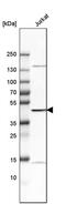 V-Set And Immunoglobulin Domain Containing 4 antibody, PA5-52018, Invitrogen Antibodies, Western Blot image 