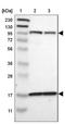 Dipeptidyl Peptidase 8 antibody, NBP1-84993, Novus Biologicals, Western Blot image 