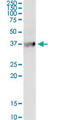 Bradykinin Receptor B1 antibody, LS-C196744, Lifespan Biosciences, Western Blot image 