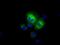 Aldehyde Dehydrogenase 3 Family Member A1 antibody, NBP2-02483, Novus Biologicals, Immunocytochemistry image 