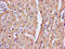 Troponin T2, Cardiac Type antibody, LS-C211523, Lifespan Biosciences, Immunohistochemistry paraffin image 
