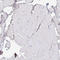 Isocitrate Dehydrogenase (NADP(+)) 1, Cytosolic antibody, HPA035248, Atlas Antibodies, Immunohistochemistry frozen image 