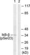 NFKB Inhibitor Beta antibody, TA314255, Origene, Western Blot image 