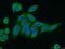 Protein Kinase C Substrate 80K-H antibody, 12148-1-AP, Proteintech Group, Immunofluorescence image 