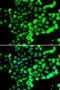 Fas-activated serine/threonine kinase antibody, 22-673, ProSci, Immunofluorescence image 