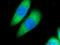 Thioredoxin Interacting Protein antibody, 18243-1-AP, Proteintech Group, Immunofluorescence image 