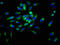 Desmoglein 3 antibody, LS-C317907, Lifespan Biosciences, Immunofluorescence image 