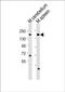 Lysine Demethylase 6A antibody, PA5-72229, Invitrogen Antibodies, Western Blot image 