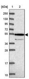 Zinc Finger Protein 565 antibody, PA5-60620, Invitrogen Antibodies, Western Blot image 