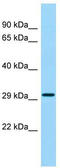 Retroviral-like aspartic protease 1 antibody, TA337970, Origene, Western Blot image 