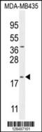 Chromosome 20 Open Reading Frame 173 antibody, 55-451, ProSci, Western Blot image 
