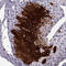 K12 antibody, HPA055835, Atlas Antibodies, Immunohistochemistry paraffin image 