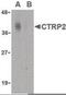 C1q And TNF Related 2 antibody, PA5-20148, Invitrogen Antibodies, Western Blot image 