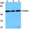 Cytochrome P450 Family 8 Subfamily B Member 1 antibody, PA5-37088, Invitrogen Antibodies, Western Blot image 
