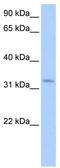 Nuclear Receptor Interacting Protein 2 antibody, TA339765, Origene, Western Blot image 