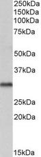 Voltage-dependent anion-selective channel protein 2 antibody, TA302629, Origene, Western Blot image 