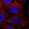 LSM Family Member 14B antibody, HPA061189, Atlas Antibodies, Immunofluorescence image 