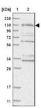 HEAT repeat-containing protein 6 antibody, NBP1-90877, Novus Biologicals, Western Blot image 