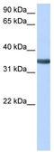 Spondin 2 antibody, TA340178, Origene, Western Blot image 