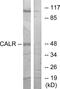 Calreticulin antibody, EKC1701, Boster Biological Technology, Western Blot image 