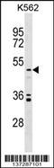 Uronyl 2-sulfotransferase antibody, 59-080, ProSci, Western Blot image 