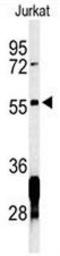 Ring Finger Protein 8 antibody, AP53695PU-N, Origene, Western Blot image 