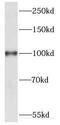 Kinesin-like protein KIF20A antibody, FNab04557, FineTest, Western Blot image 