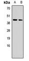 TRNA Methyltransferase 9B (Putative) antibody, LS-C668982, Lifespan Biosciences, Western Blot image 