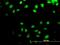 5', 3'-Nucleotidase, Cytosolic antibody, H00030833-B01P, Novus Biologicals, Immunocytochemistry image 