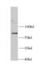 TFIIH basal transcription factor complex helicase XPB subunit antibody, FNab02834, FineTest, Western Blot image 
