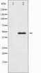 PTPN1 antibody, TA327856, Origene, Western Blot image 