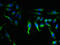 Potassium Calcium-Activated Channel Subfamily M Regulatory Beta Subunit 1 antibody, LS-C377528, Lifespan Biosciences, Immunofluorescence image 