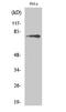 Bruton Tyrosine Kinase antibody, STJ90447, St John
