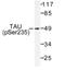 PHF-tau antibody, AP01704PU-N, Origene, Western Blot image 