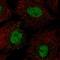 BARX Homeobox 1 antibody, HPA055858, Atlas Antibodies, Immunofluorescence image 