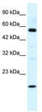Zinc Finger Protein 436 antibody, TA334213, Origene, Western Blot image 