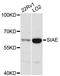 Sialic Acid Acetylesterase antibody, LS-C748280, Lifespan Biosciences, Western Blot image 