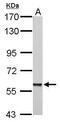 Poly(ADP-Ribose) Polymerase Family Member 3 antibody, PA5-21478, Invitrogen Antibodies, Western Blot image 