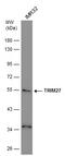 Zinc finger protein RFP antibody, GTX102098, GeneTex, Western Blot image 