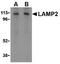 Lysosomal Associated Membrane Protein 2 antibody, ADI-905-723-100, Enzo Life Sciences, Western Blot image 