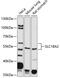 Solute Carrier Family 18 Member A2 antibody, 18-818, ProSci, Western Blot image 