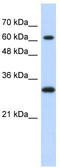 ETS2 Repressor Factor antibody, TA330218, Origene, Western Blot image 