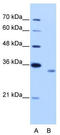 RBM4B antibody, TA343945, Origene, Western Blot image 