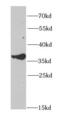 UDP-Galactose-4-Epimerase antibody, FNab03309, FineTest, Western Blot image 