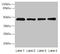 Probable palmitoyltransferase ZDHHC23 antibody, CSB-PA818262LA01HU, Cusabio, Western Blot image 