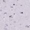 Histone Cluster 1 H1 Family Member T antibody, PA5-66983, Invitrogen Antibodies, Immunohistochemistry paraffin image 